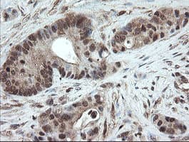 Monoclonal Mouse anti-Human PNPO Antibody (clone OTI1G9, IHC, WB)