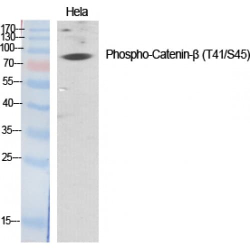 Polyclonal Rabbit anti-Human CTNNB1 / Beta Catenin Antibody (30-110 aa, WB)