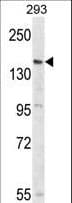 Polyclonal Rabbit anti-Human PCDH17 Antibody (aa1107-1136, WB)