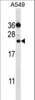 Polyclonal Rabbit anti-Human PSMD10 / Gankyrin Antibody (aa184-213, WB)
