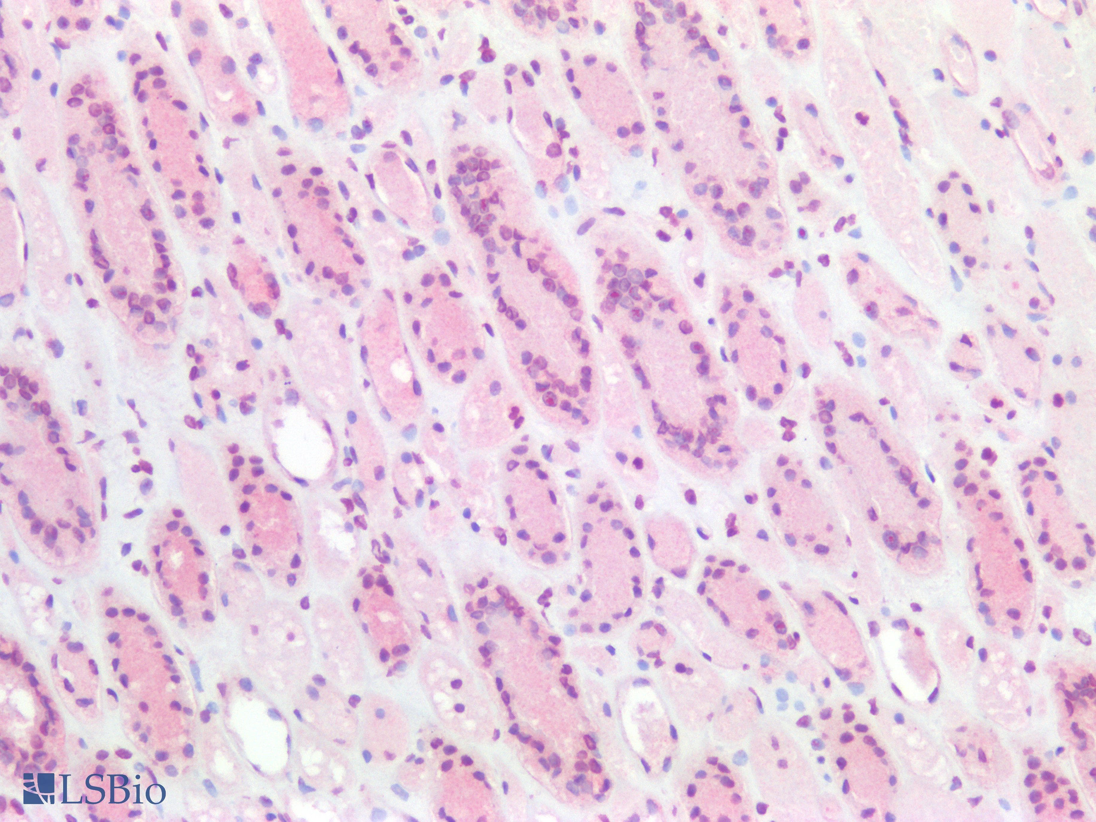 PathPlus™ ERG Antibody (clone 8A9)