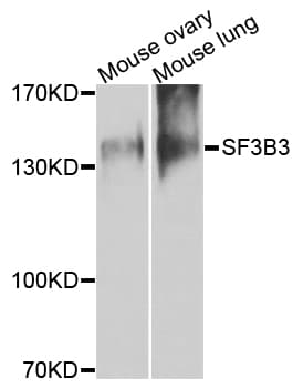 IHC-plus™ SF3B130 / SF3B3 Antibody