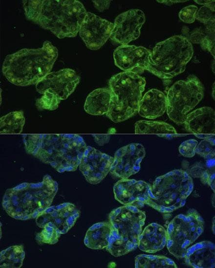 KRT13 / CK13 / Cytokeratin 13 Antibody