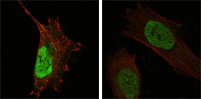 IHC-plus™ Monoclonal Mouse anti-Human MDM4 / MDMX Antibody (clone 2D10F4, aa 2-185, IHC, IF, WB)
