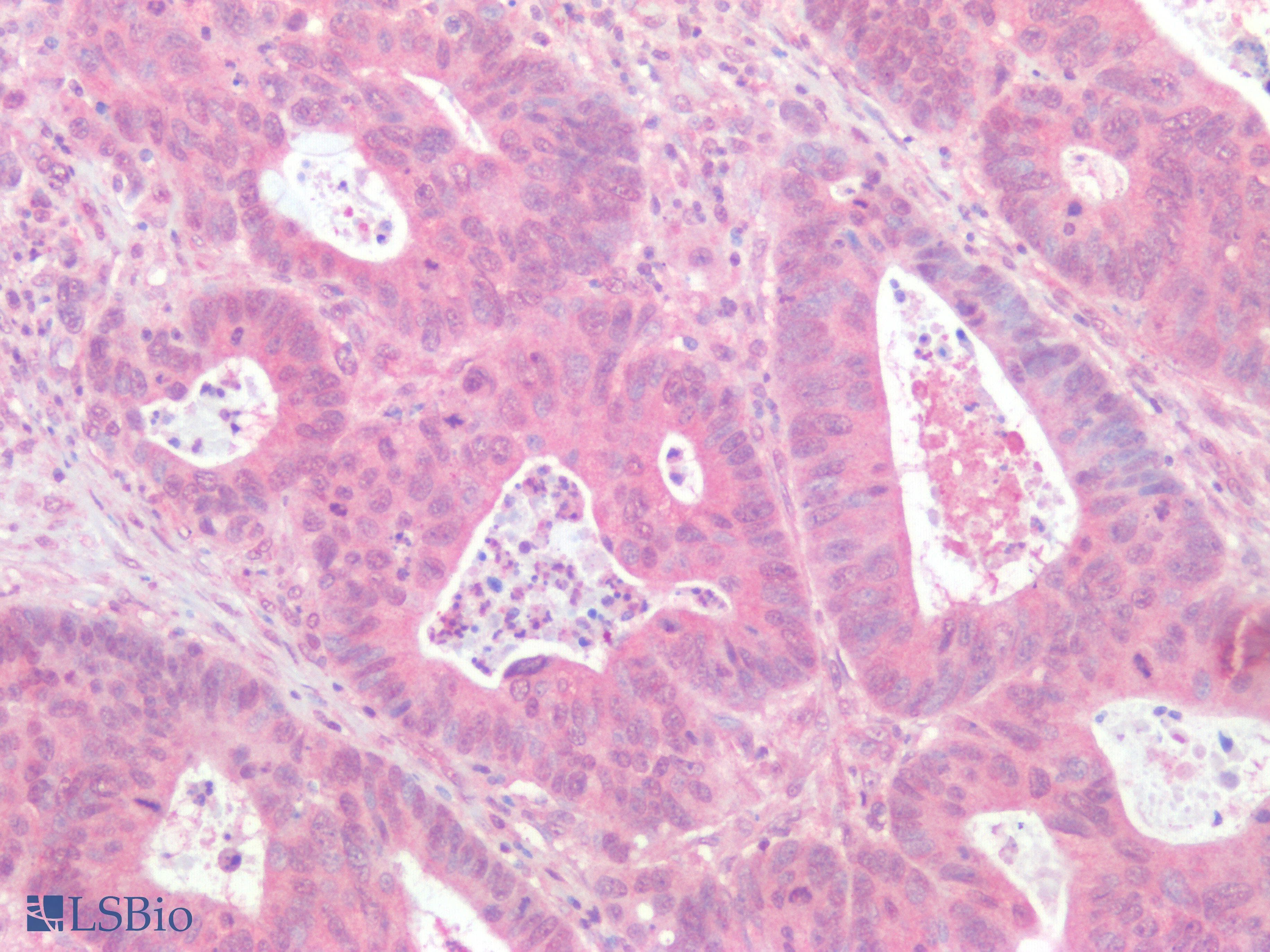 IHC-plus™ Polyclonal Rabbit anti-Human PIK3CA / PI3K Alpha Antibody (IHC)