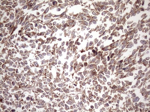 KRT16 / CK16 / Cytokeratin 16 Antibody (clone OTI6A11, Carrier-free)
