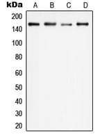 PLCG1 Antibody (Internal)