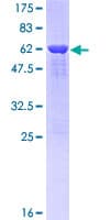 Human TDP-43 / TARDBP Protein (Recombinant GST, N-terminus)