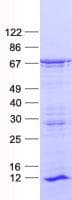 Human ZNF460 Protein (Recombinant His, N-Terminal)