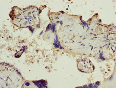 Polyclonal Rabbit anti-Human SLC6A6 / Taurine Transporter Antibody (IHC, WB)