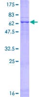 Human WDR57 Protein (Recombinant GST)