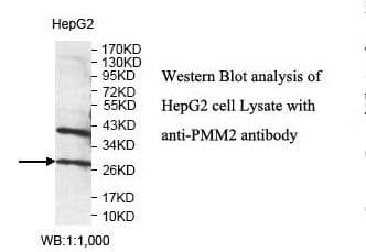 Polyclonal Rabbit anti-Human PMM2 Antibody (aa40-234, IHC, WB)