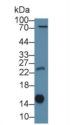 LGALS1 / Galectin 1 Antibody (aa1-135, APC)
