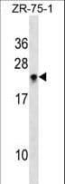 Polyclonal Rabbit anti-Human TTF / RHOH Antibody (aa155-184, WB)