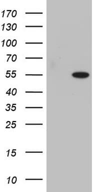 Monoclonal Mouse anti-Human SAP30BP / HTRG Antibody (clone OTI2H7, aa1-260, WB)