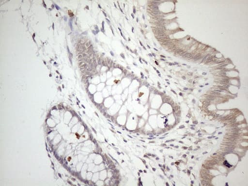 ZNF69 Antibody (clone OTI3D11, Carrier-free)