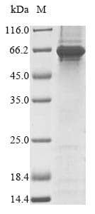 Mouse FAM20C Protein (Recombinant 10His, N-terminus + Myc, C-terminus)