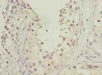 Polyclonal Rabbit anti-Human HOOK1 Antibody (IHC, WB)