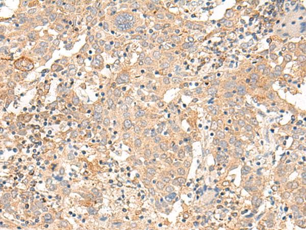 Polyclonal Rabbit anti-Human CORO2A Antibody (IHC)