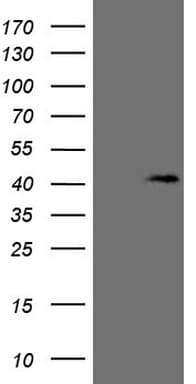 KCTD13 Antibody (clone OTI1A4)