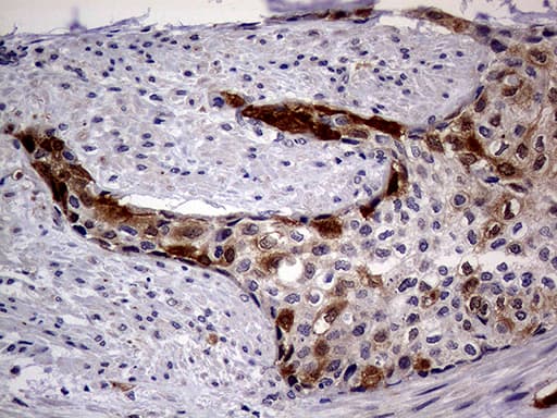 p16INK4a / CDKN2A Antibody (clone OTI11D3)