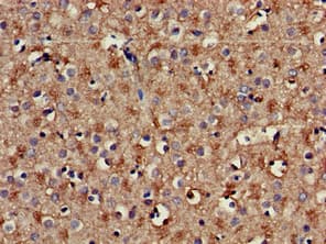 PLCB1 / Phospholipase C Beta 1 Antibody