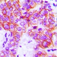 Polyclonal Rabbit anti-Human FAK / Focal Adhesion Kinase Antibody (C-Terminus, IHC, IF, WB)