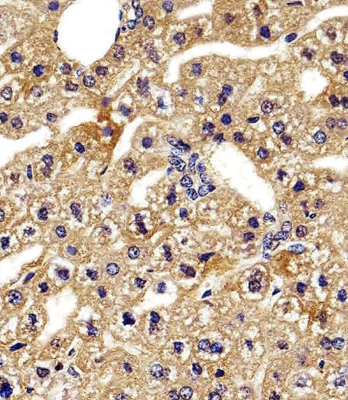 HBG2 / Hemoglobin Gamma 2 Antibody (aa101-133)