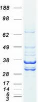 Human LDHB / Lactate Dehydrogenase B Protein (Recombinant Myc-DDK (Flag))