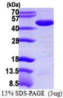 Human PME-1 / PPME1 Protein (Recombinant His)
