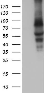 CAPN5 / Calpain 5 Antibody (aa274-578, clone OTI4H5, Carrier-free)