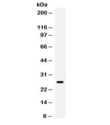 APOA1 / Apolipoprotein A 1 Antibody