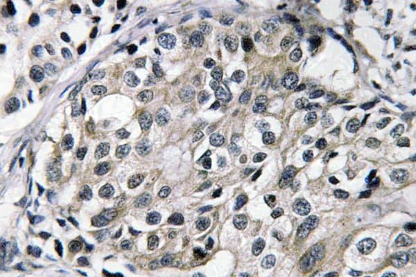 Tyrosine Aminotransferase Antibody (Glu304)