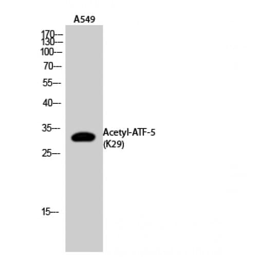Polyclonal Rabbit anti-Human ATF5 Antibody (acetylation site of K29., WB)