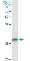 IHC-plus™ HLA-DPB1 Antibody (clone 6C6)