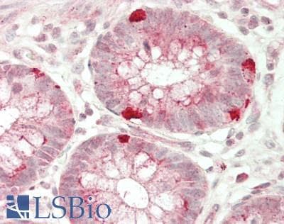 IHC-plus™ MYO1B / Myosin IB Antibody (aa916-1136)