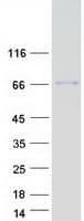 Human SLC39A4 / ZIP4 Protein (Recombinant Myc-DDK (Flag))
