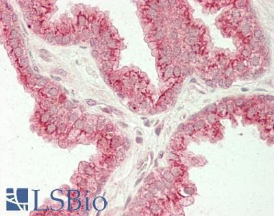 IHC-plus™ Polyclonal Rabbit anti-Human CANT1 Antibody (aa 80-397, IHC)