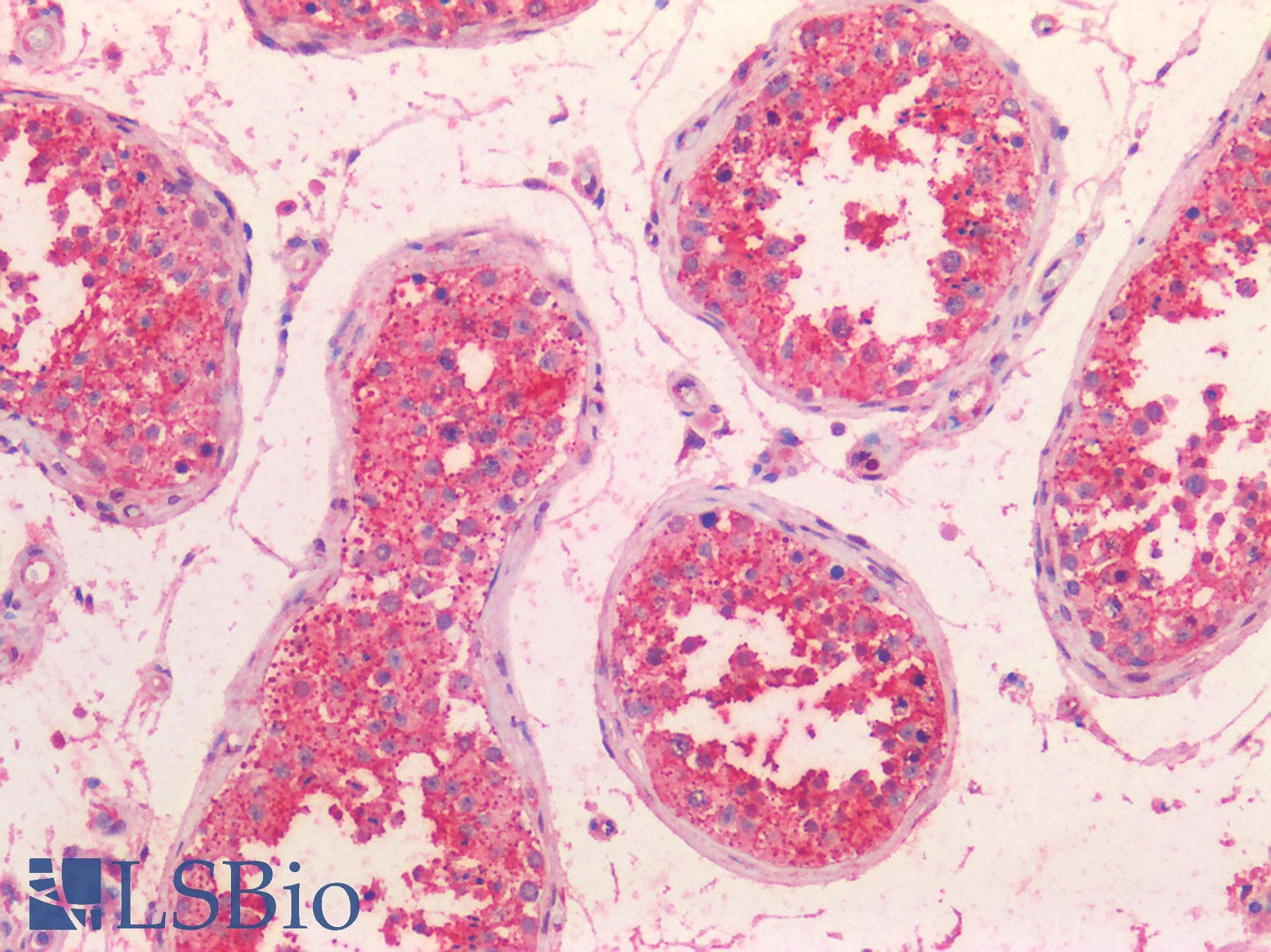 IHC-plus™ Polyclonal Rabbit anti-Human HTR2C / 5-HT2C Receptor Antibody (C-Terminus, IHC)
