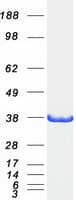Human BABP / AKR1C2 Protein (Recombinant Myc-DDK (Flag))