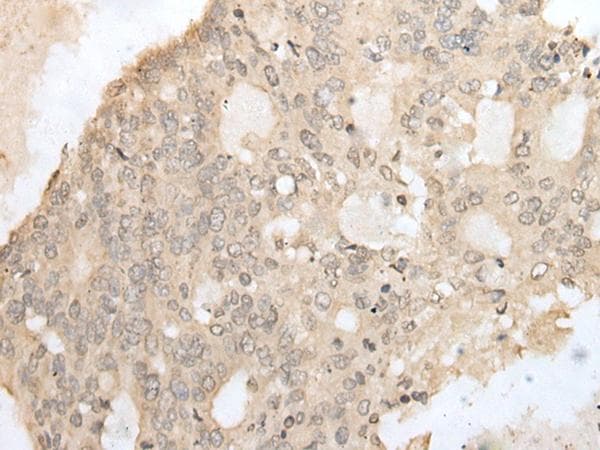 ATAC1 / ZZZ3 Antibody