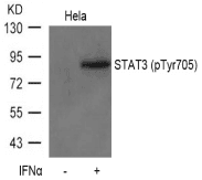 Polyclonal Rabbit anti-Human STAT3 Antibody (IHC, WB)
