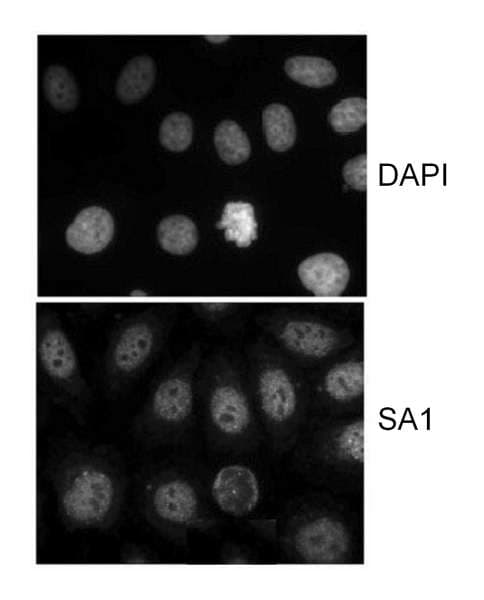 STAG1 / SA1 Antibody (aa1150-1200)
