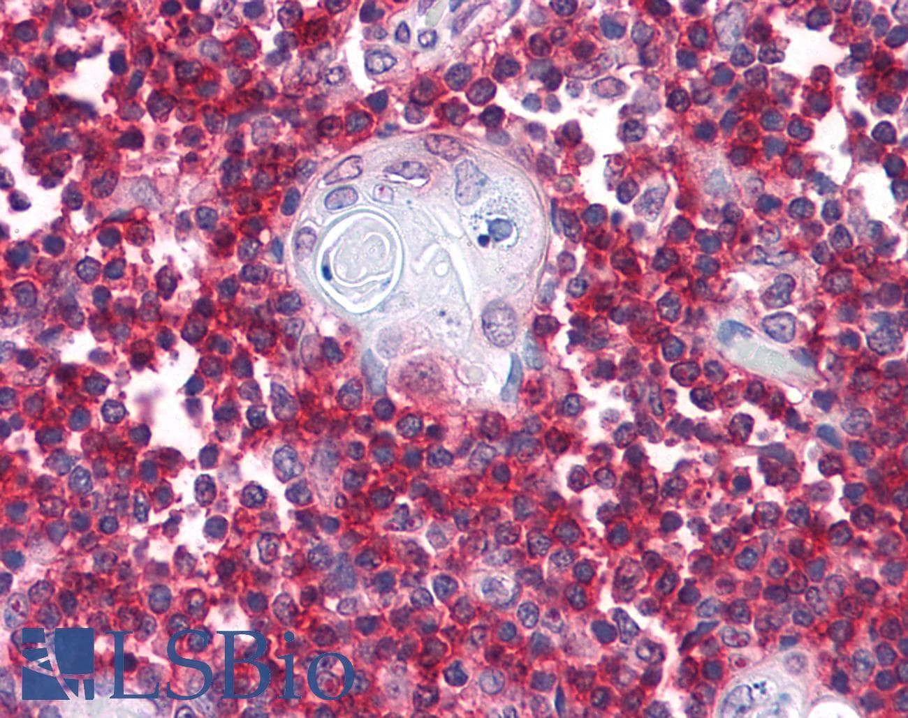 IHC-plus™ Monoclonal Mouse anti-Human CD247 / CD3 Zeta Antibody (clone 4B10, aa52-164, IHC, IF, WB)