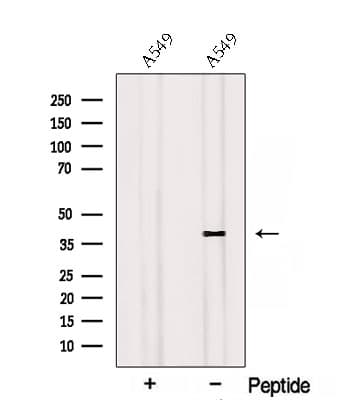 RSPO3 Antibody