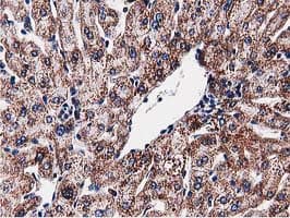 SQSTM1 Antibody (clone OTI5A2)