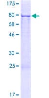 Human TOR1AIP1 / LAP1 Protein (Recombinant GST)