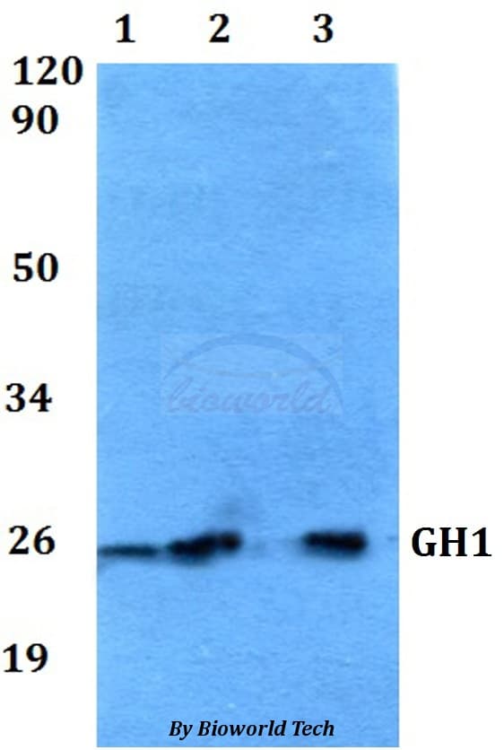 Polyclonal Rabbit anti-Human GH / Growth Hormone Antibody (WB)