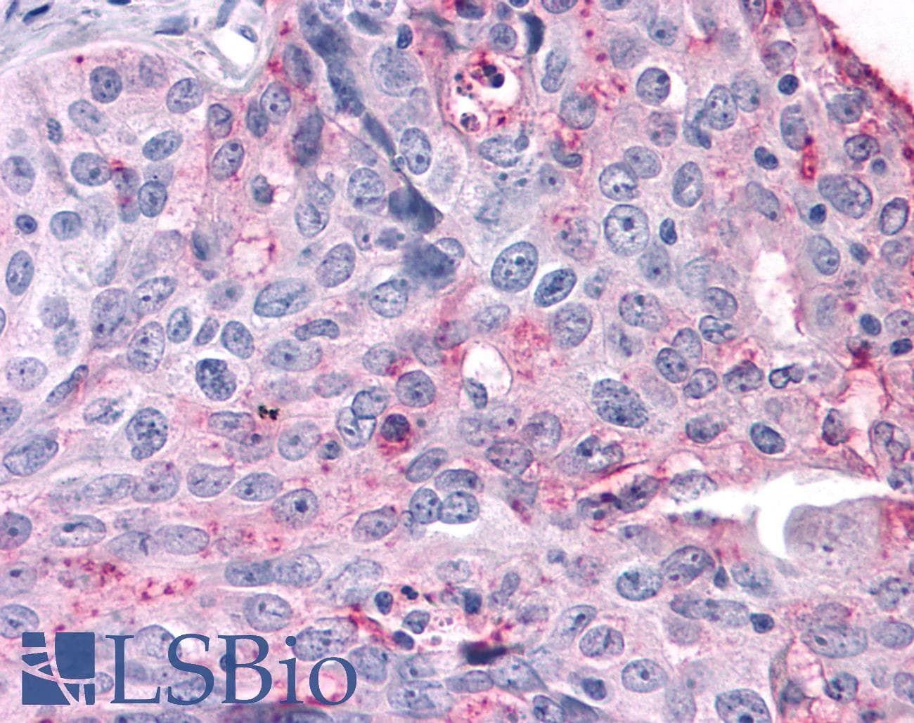 IHC-plus™ Polyclonal Rabbit anti-Human SGK3 Antibody (Internal, IHC)