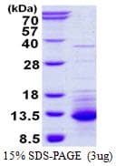 Human CXCL11 Protein (Recombinant His)